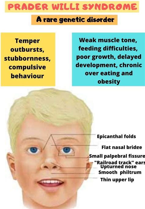 symptoms of prader willi syndrome